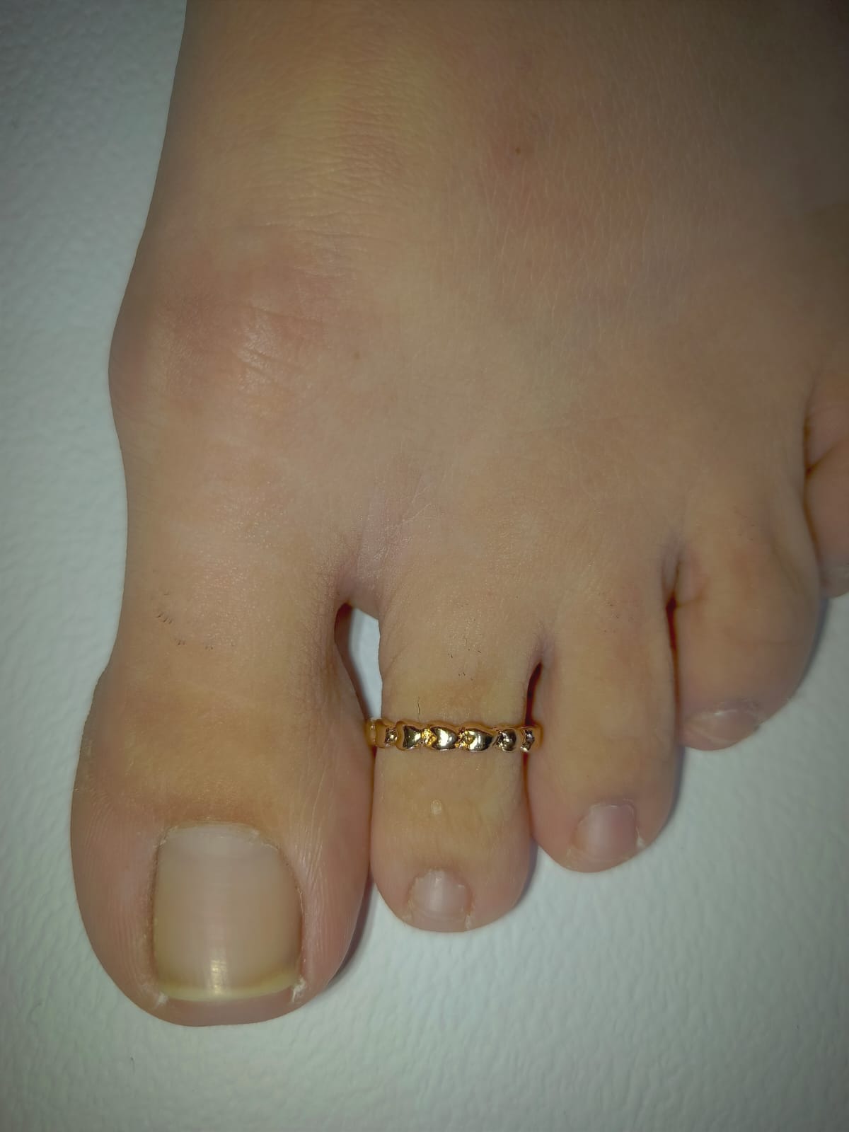 Anillo para el pie 